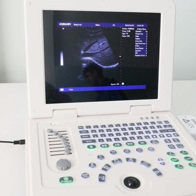 qualidade  GYN Factory Supply Dw580 Portable Ultrasound Machine For Sale fábrica