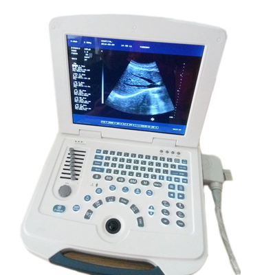 Máquina portátil multilingue do ultrassom da operação fácil de aço